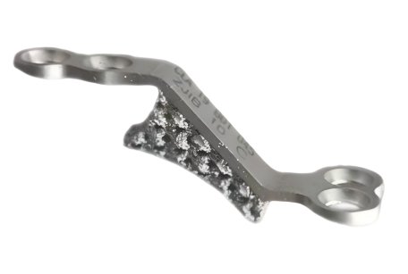 椎板固定板系统（3D打印）