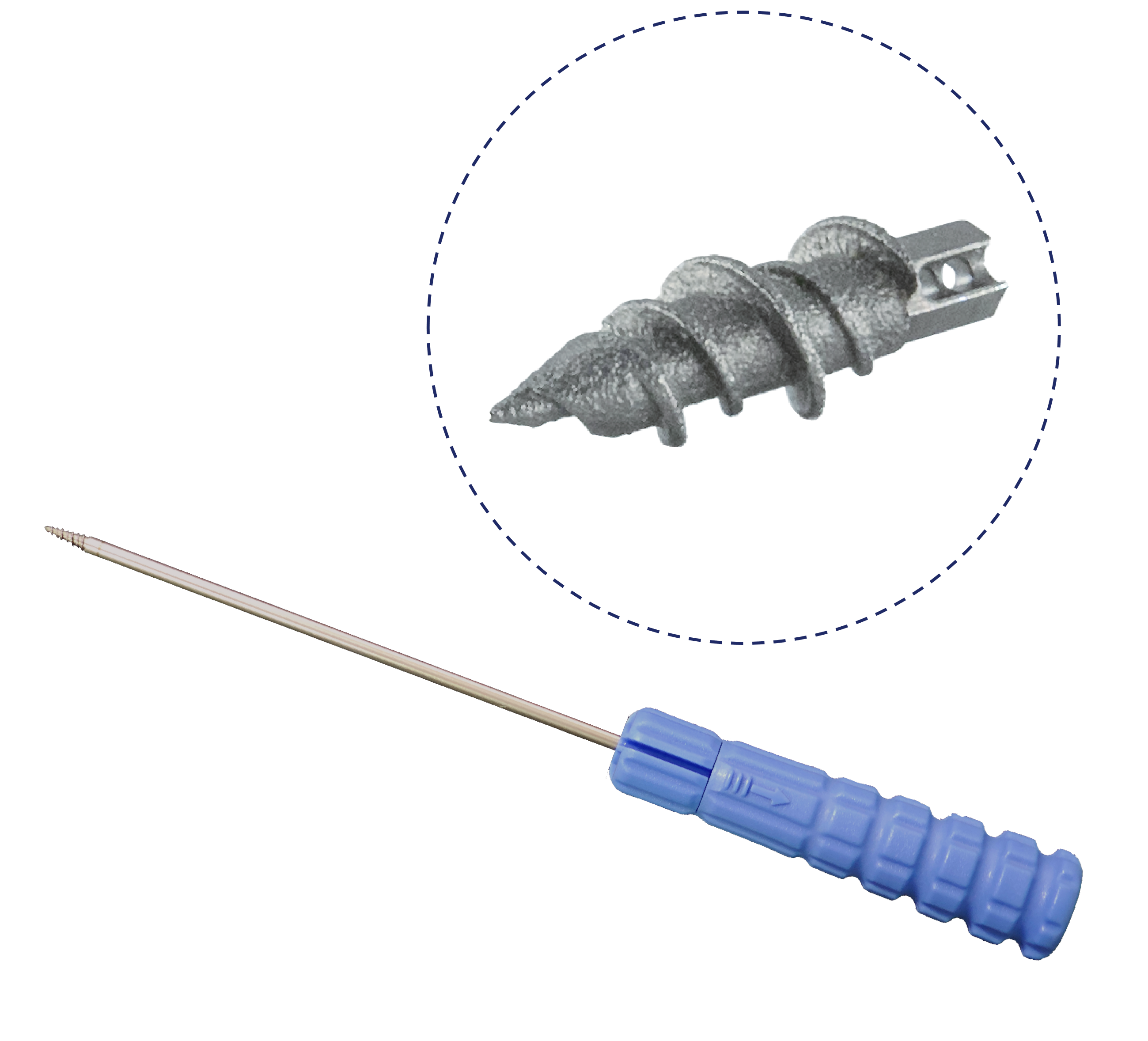3D打印鈦合金錨釘