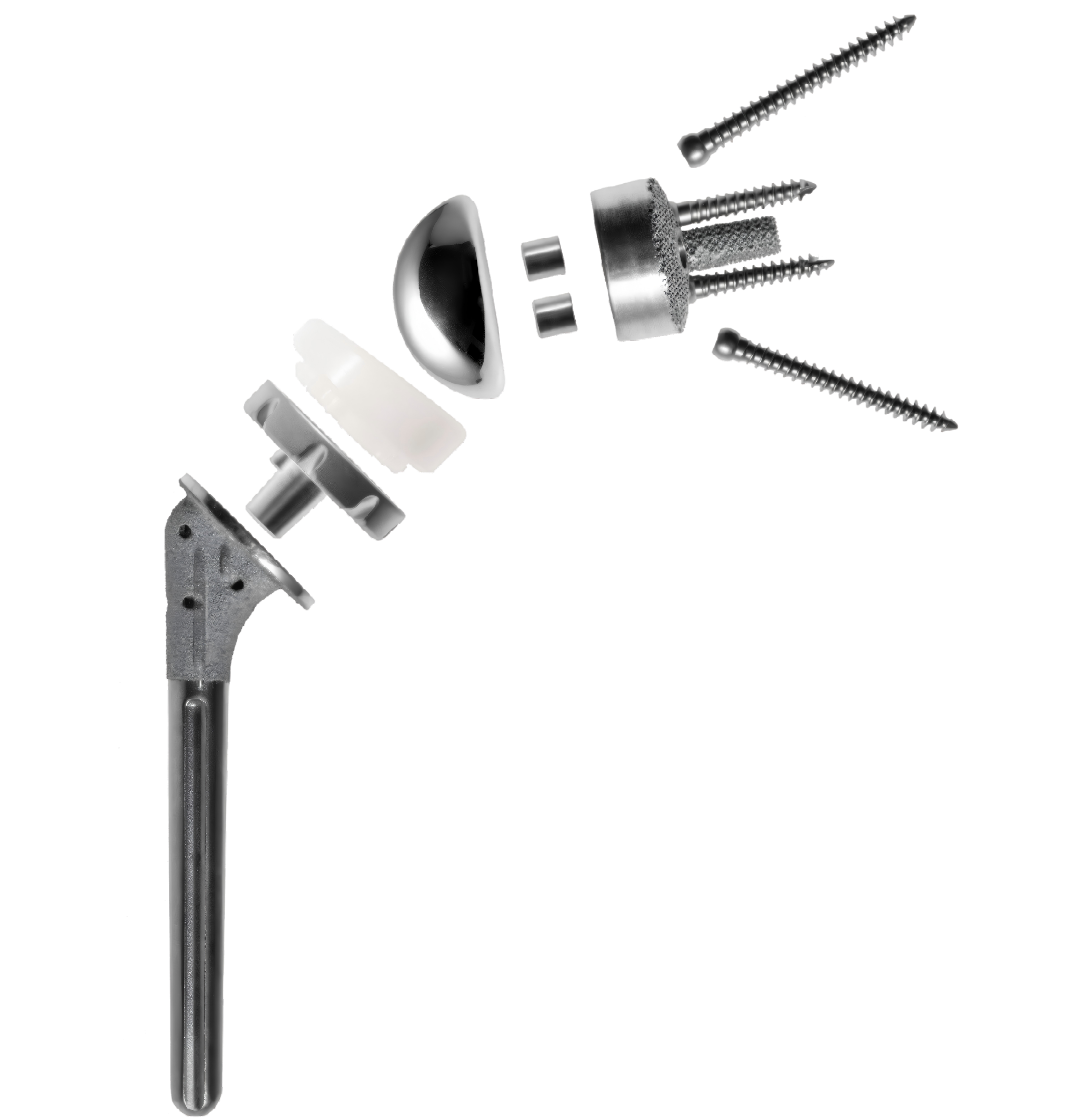 Reverse shoulder arthroplasty