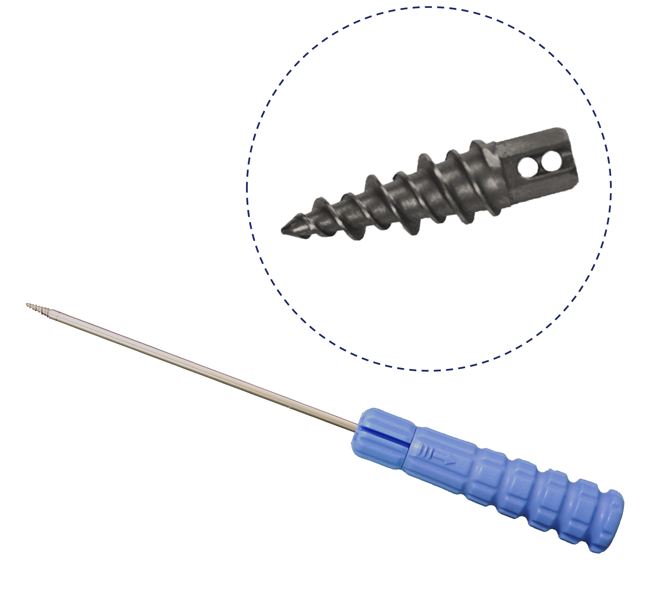 鉭塗層帶線錨釘